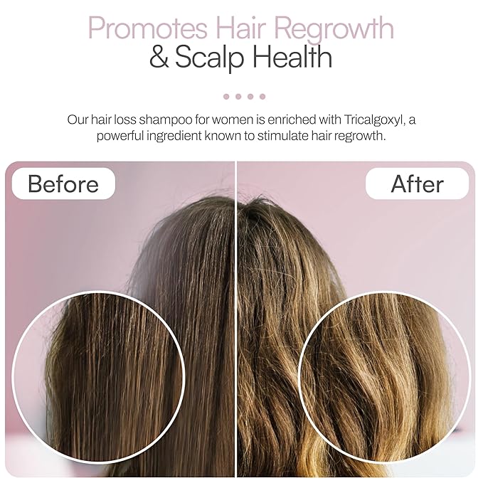 Foltene Strengthening Shampoo for Women – Reduces Thinning, Boosts Volume, and Enhances Hair Health – Silicone & Sulfate-Free Hair Thickening Shampoo for Fuller Strands (6.76 fl. oz.)