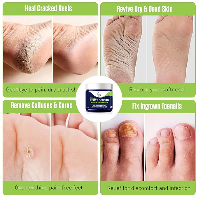 Exfoliating Foot Scrub with Pumice Stone powder - Gentle Moisturizing Foot Scrub for Dry Skin - Cracked Heel Repair for Smooth, Soft Feet - Pedicure Foot Spa 2 Pack