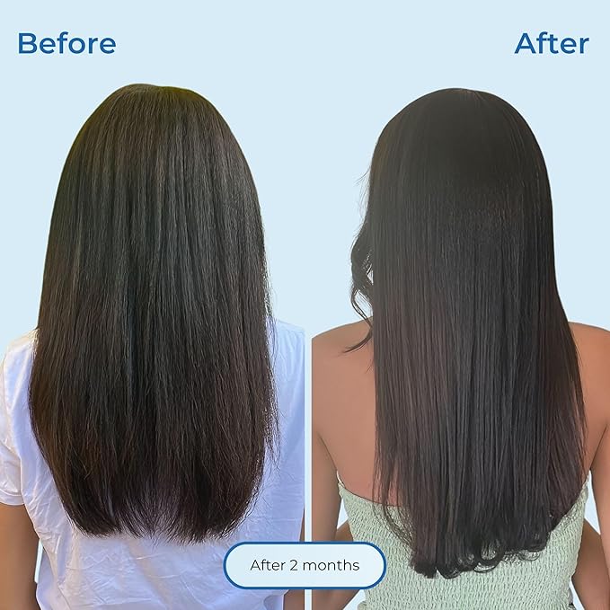 Agua de Cielo Hair Energizing Drops - Nourishing Hair Follicle Stimulator, Growth Oil Infused with Biotin, Ginger, Collagen & Peppermint, Supports Healthy Strands - 4 Oz