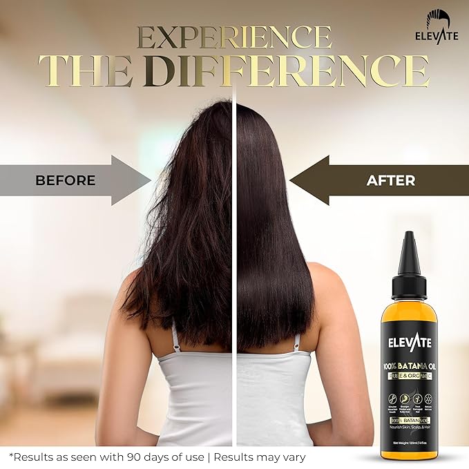 Elevate Batana Oil for Hair Growth | 100% Pure & Natural Raw Dr. Sebi Organic Oil from Honduras | Cold Pressed Chemical-Free for Thickness & Scalp Care Skin | Thicker Stronger Hair 4 Fl Oz 2 Pack