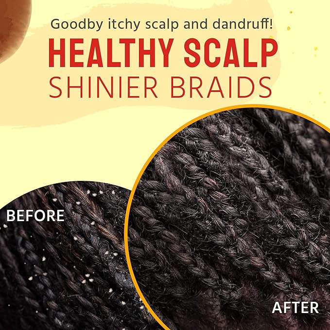 Glammed Naturally Scalp Oil for Dry Itchy Scalp - Includes Castor Oil for Hair, Dandruff, Locs, Tension Relief Hair Oil Applicator for Scalp Care 4 oz