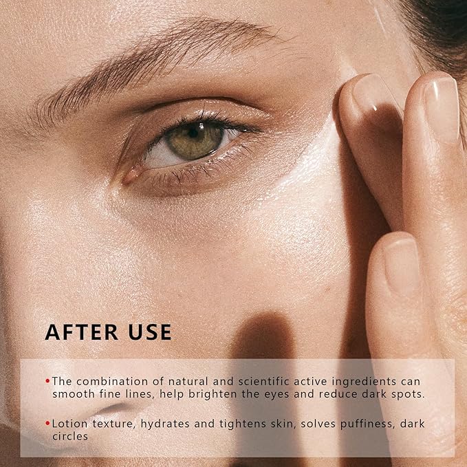 20ML/ 0.6FL OZ Eye Serum, Eye Cream for Dark Circles, 360° Massage Roller-Ball Under Eyes Treatment Eyes Serum for Wrinkles Fine Lines, Under Bags Anti Aging For Women & Men