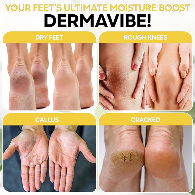 Premium 40% Urea Cream For Feet - Made In USA - Maximum Strength with Pumice Stone & Brush | Tested by Doctors | Intense Moisturizer & Corn, Callus and Dead Skin Remover, Dermavibe by DOCTOR'S INC.