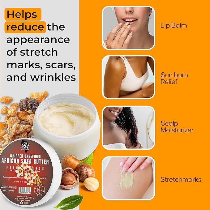 RA COSMETICS Whipped Shea Butter Frankincense - 6oz | 100% Pure & Natural African Shea Butter for Men & Women - Handcrafted Moisturizer with Essential Vitamins for Softer Lips, Healthier Skin & Hair