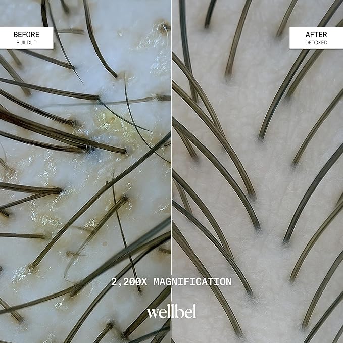 WELLBEL Gelée Detox Shampoo – pH-Balanced Scalp Detox, Gently Exfoliates & Removes Buildup, Dermatologist-Tested, Color-Safe, Hydrating & Strengthening Formula for Healthy, Bouncy Hair