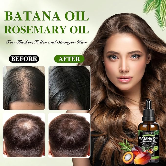 Batana Oil for Hair Growth and Rosemary Oil for Hair Growth, Nourish Dry Damaged Hair, Promote Thicker & Stronger Hair for Men Women, with Hair Oil Applicator, 2.02 Fl Oz