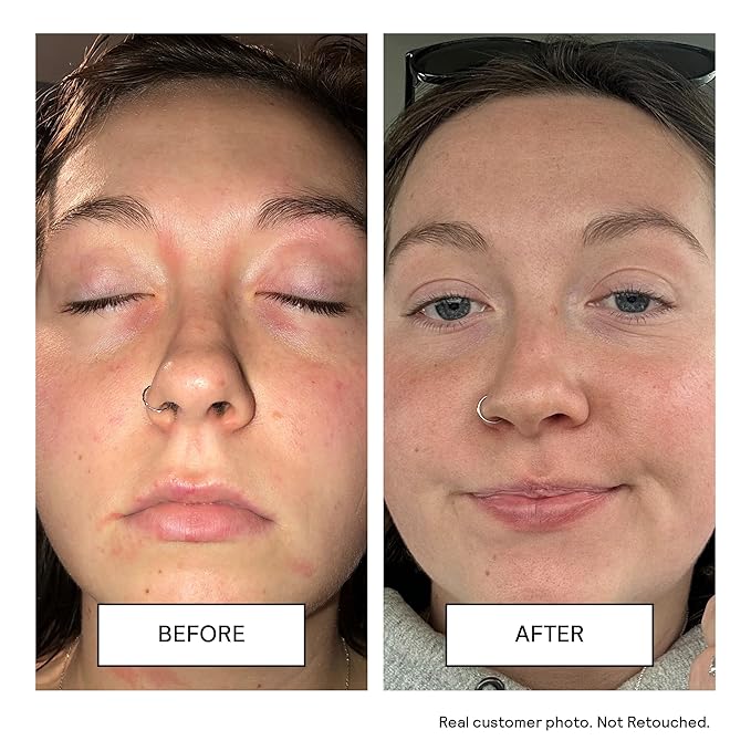 Untoxicated Face Wash - Gentle & Hydrating Face Cleanser for Sensitive Skin - Ceramides, Hyaluronic Acid & Glycerin - No Common Irritants - Non-Foaming - Soap Free - Fragrance Free - 7 Ounce