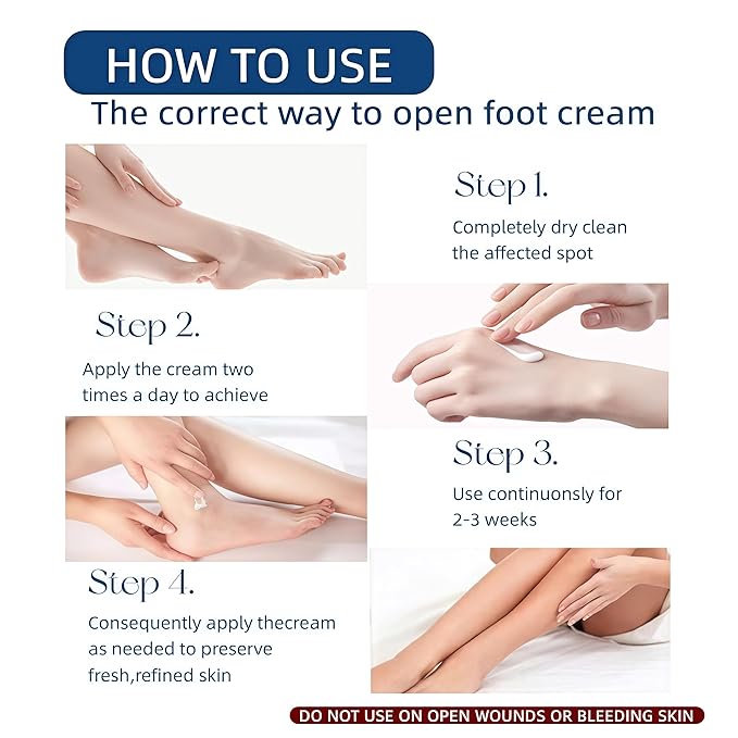 40% Urea Foot Cream with 2% Salicylic Acid Dry, Cracked Heel Treatment Callus Remover for Feet, Hands, Elbows Knees Tea Tree, Aloe Hyaluronic Acid Moisturizing Formula, 5.29 oz