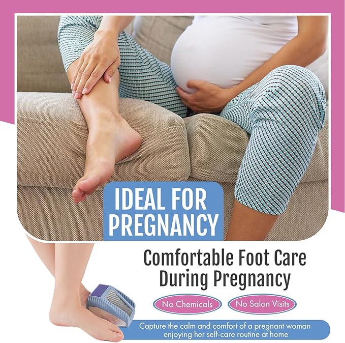 Wonex U.S. Patented 3-in-1 Foot Scrubber – No-Bend Callus Remover, Nano Glass Buffer & Polisher for Smooth Feet – Ideal for Senior Aids, Pregnancy Must-Haves, Back & Knee Surgery Recovery Gift (Grey)