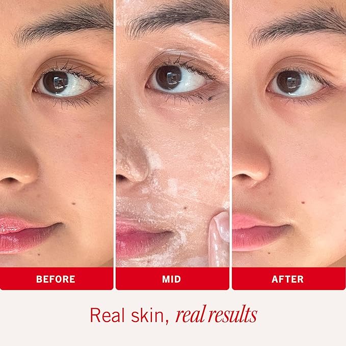 First Aid Beauty - Pure Skin Face Cleanser, Effectively Removes Makeup, Dirt, and Impurities, Gentle Cleanser Leaves Skin Soft & Supple, Safe for Sensitive Skin, Fragrance Free, 10 oz