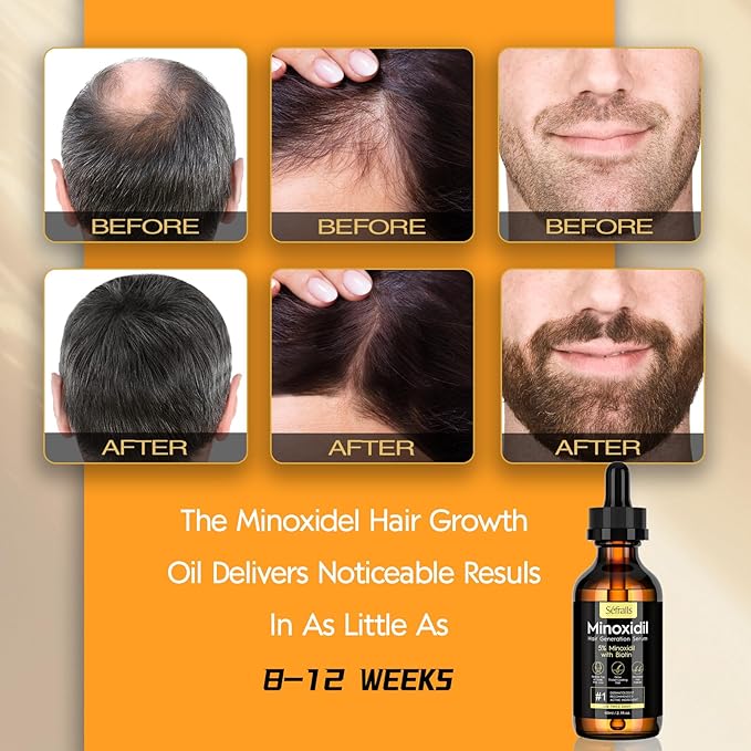 5% Minoxidil Hair Growth Oil for Men & Women - Extra Strength Regrowth Serum, Topical Hair Loss Treatment Serum, Thicker, Healthier Hair & Beard Growth Kit, 2.11 fl.oz