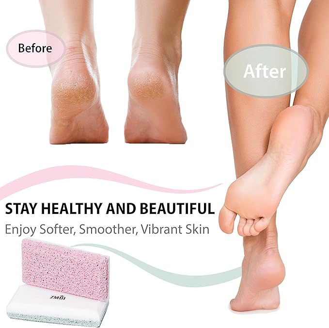 Siliglass Pumice Stone Callus Remover for Feet, Elbows, Hands, and Knees, Spain Made - 2 in 1 Pedicure Exfoliator and Scrubber for Rough, Hard Skin (1 Pack)