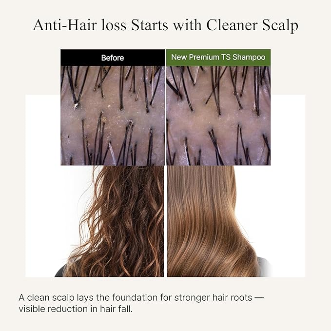 TS New Premium Shampoo | Korean Hair Loss Care for Thinning Hair with Biotin & Niacinamide | Zinc Pyrithione & 19 Botanical Extracts | Sulfate-Free Creamy Formula for Scalp Health (16.91Fl Oz/ 500ml)