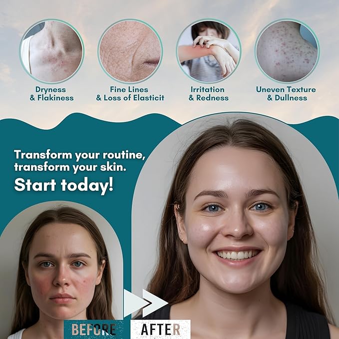 Beef Tallow for Skin – Whipped Tallow and Honey Balm, Grass Fed Beef, Face Moisturizer for Dry and Sensitive Skin, Natural and Nourishing Body Butter, 4 oz