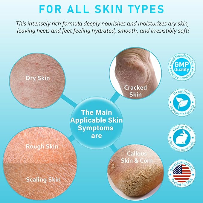 Urea Cream 40 Percent For Feet Maximum Strength - plus Salicylic Acid 2% Foot Cream For Dry Cracked Heels Feet Knees - Dead Skin Cuticle Callus Remover Toenail Softener - Lightly Camellia Scent