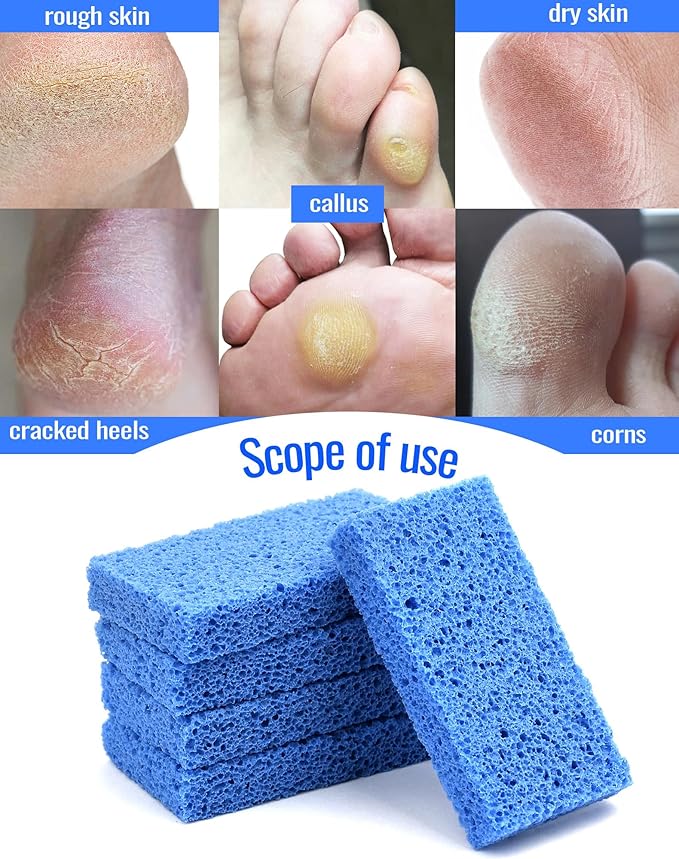 Maryton New Sharper Pumice, Professional Pedicure Tools Foot Scrubber Salon Disposable Pumice Stone Callus Remover for Feet, 40Pcs (Blue)