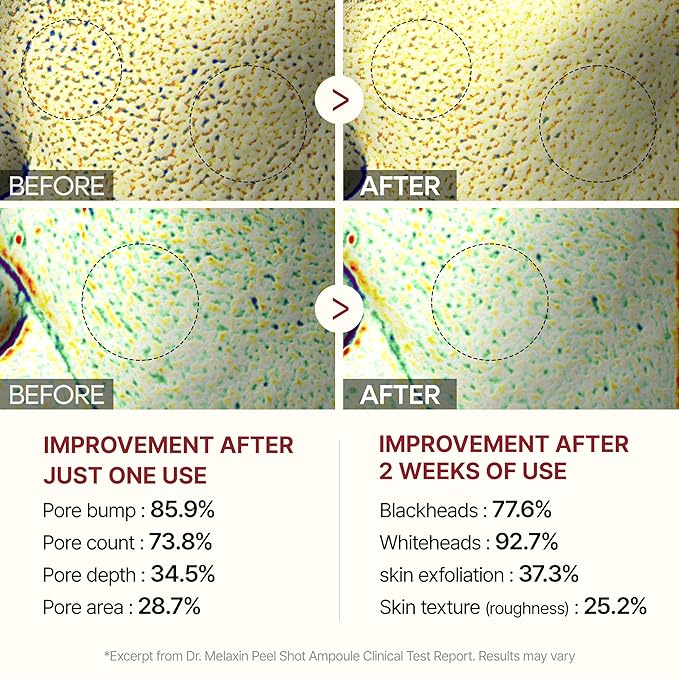 Dr.Melaxin Peel Shot Glow Rice Peeling Ampoule 80ml Daily Soft Exfoliating Face and Body Scrub Dead Skin Cells Blackhead Remover for All Skin Types korean skin care