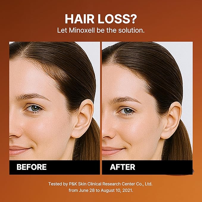 Scalp Intensive Shampoo with Biotin | Korean Shampoo for Hair Loss, Hair Regrowth, Thinning Hair, Volume Boost & Damage Repair (13.52 fl oz)