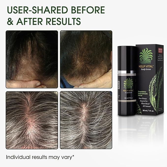 Kelp Vital Hair Growth Serum for Thinning Hair, Daily Scalp Care, Plant-Based Ingredients, Lightweight Non-Greasy, Follicle-Nourishing, Hair Thickening Treatment For Women & Men, 30 mL Airless Pump
