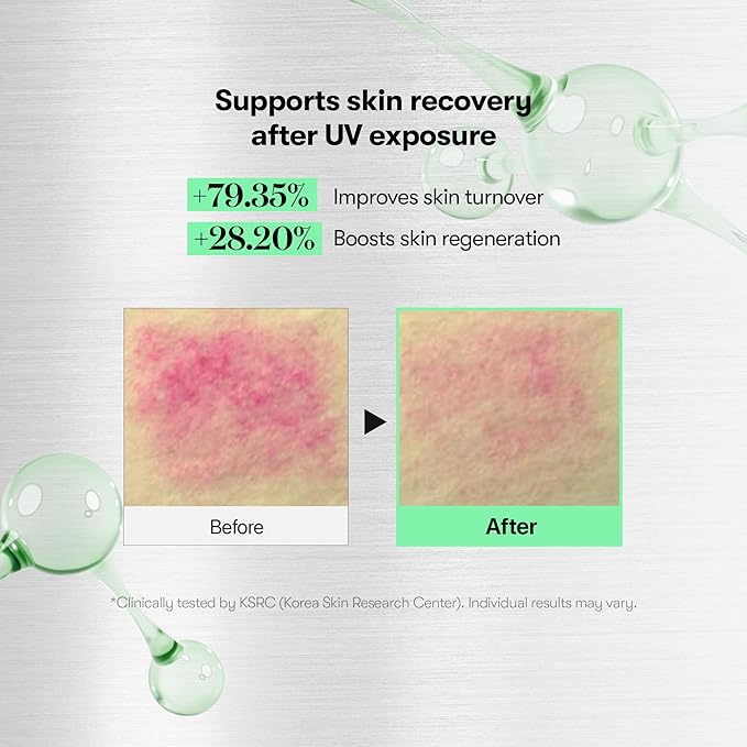 VT COSMETICS CICA Reedle Shot 700, Spicule Microneedling Serum for Pore Care&Exfoliation, Exosome&Centella Asiatica for Glass Skin, Acne&Blemish Care, Korean Liquid Skin Booster (1 Fl Oz / 30ml)