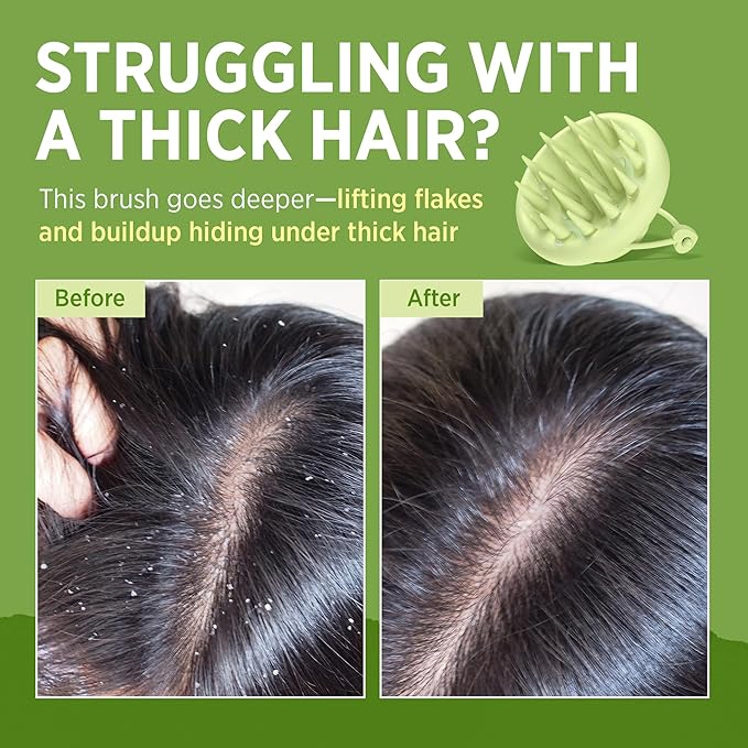 Roycederm Scalp Massager Brush Hair Scrubber – Soft Silicone Shampoo Brush for Scalp Care, Itchy Relief & Deep Cleansing – Ideal for Dandruff, Seborrheic Dermatitis & Scrub Use