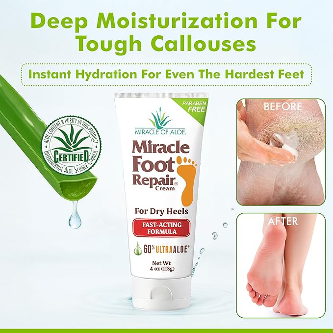 Miracle Foot Repair Cream, 4 oz Repairs Dry Cracked Heels and Feet, Diabetic-Safe, 60% Pure Ultra Aloe Moisturizes, Softens, and Repairs, Relief from Discomfort of Ingrown Toenails (2-Pack)