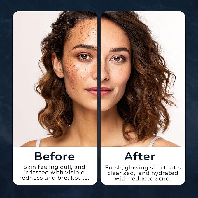 Neptune Black Sea Mud Scrub 3 Fl Oz | Deep Cleansing & Exfoliating Face Scrubber for Acne, Razor Bumps & Redness | Hydrates & Soothes Skin with 100% Natural, EWG Verified Ingredients