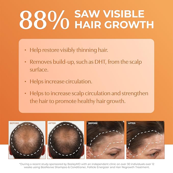 BosleyMD BosRevive Color-Safe Hair Care Kit for Thinning Hair, Starter Size (30 Days) – Shampoo, Conditioner & Thickening Treatment with Biotin, Panthenol & Botanical Extracts