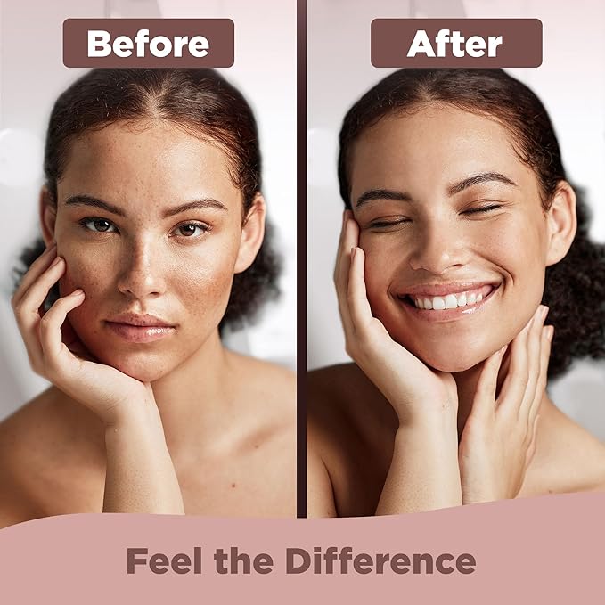 Bionyx Rhodium Complex Facial Peeling Gel - Anti Aging Face Peel for All Skin Types - Exfoliating Gel With Colloidal Platinum for Smooth, Supple Skin - 1.76 Fl. Oz.