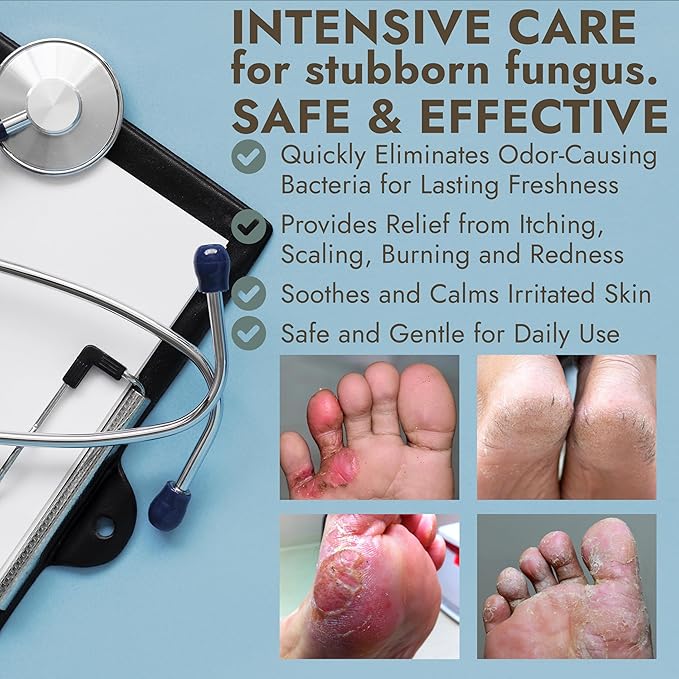 Antifungal Foot Powder with Miconazole Nitrate 2% & Tea Tree Oil for Foot Fungus Treatment | Soothes Itchy Skin, Controls Odor & Prevents Reinfection | Powder for Athlete’s Foot Relief | Pack of 3