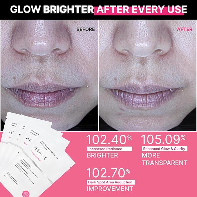 Toning Active Mask – Brightening, Hydrating&Soothing Face Mask with Tranexamic Acid & Hyaluronic Acid, Sheet Mask with Coconut Fiber, Gentle for Sensitive Skin, Korean Skin Care, Vegan, 5EA