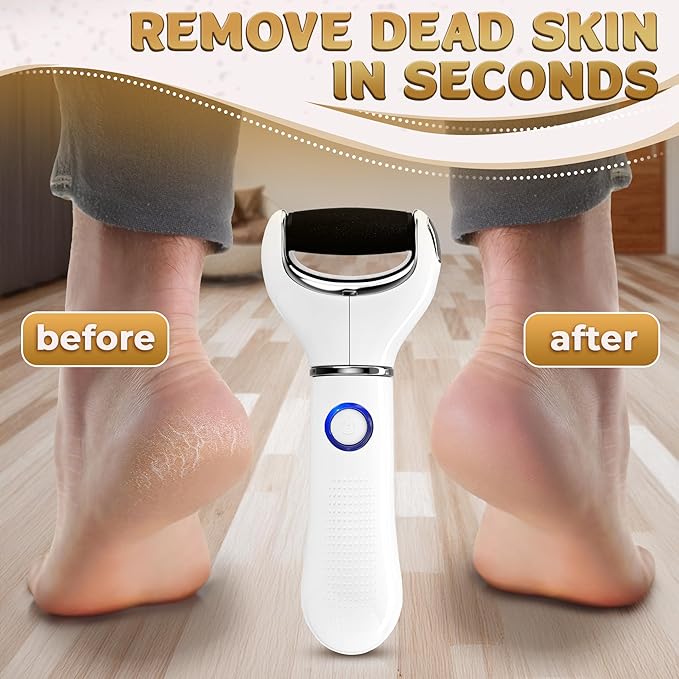 Rechargeable Electric Foot File Callus Remover – 3-Speed Foot Scrubber Electric (1800/2200/2800 RPM), Dry Skin Remover for Feet – 1200mAh, 70 Min Runtime, 2 Replacement Rollers 80 and 60 Grit