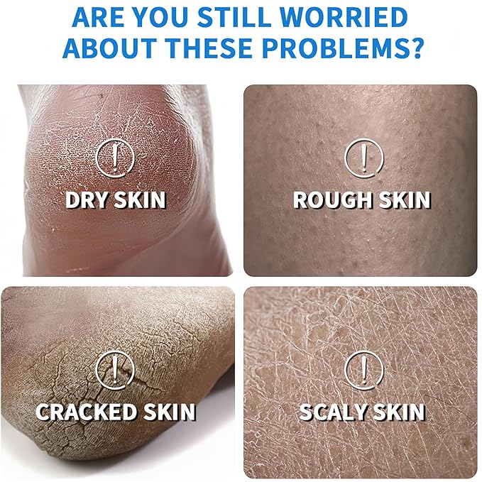 2PCS Foot Cream Set – 60% Urea Foot Cream & Peach Scent Heel Balm Stick – Exfoliating & Moisturizing Foot Care Duo for Dry Cracked Heels & Feet, 1.41oz Each