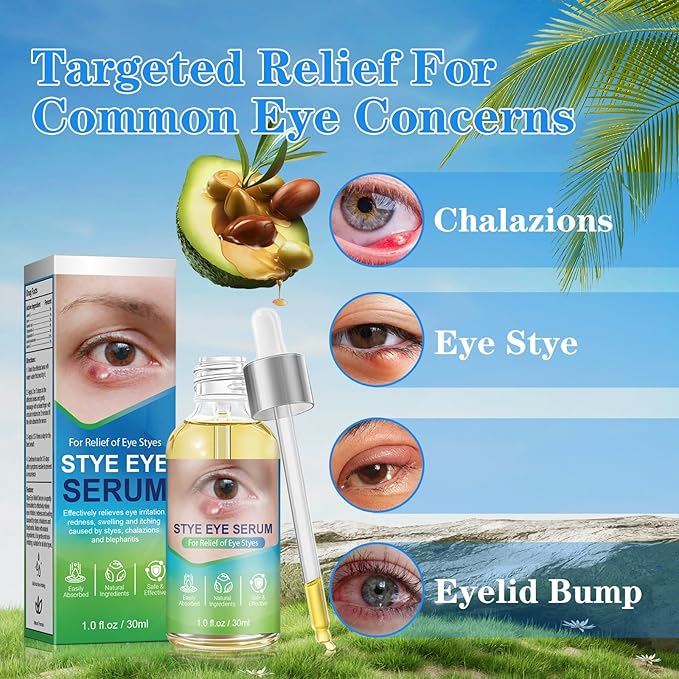 Stye Relief Serum & Eyelid Drops for Blepharitis & Chalazion | Natural Fast-Acting Formula for Lash Line & Under Eye | Gentle Cleansing Care, 1 Fl Oz