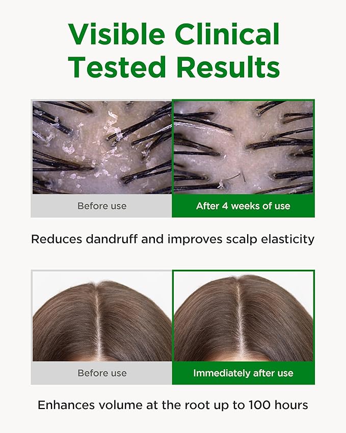 CKD Amino Biotin All powerful Treatment (5.07 fl.oz) - Deep Care Conditioner and Silicone-Free Treatment, Prevents Damaged Hair, Nourishihes Hair, Non-Silicone with Biotin, Amino Acids, and Keratin.