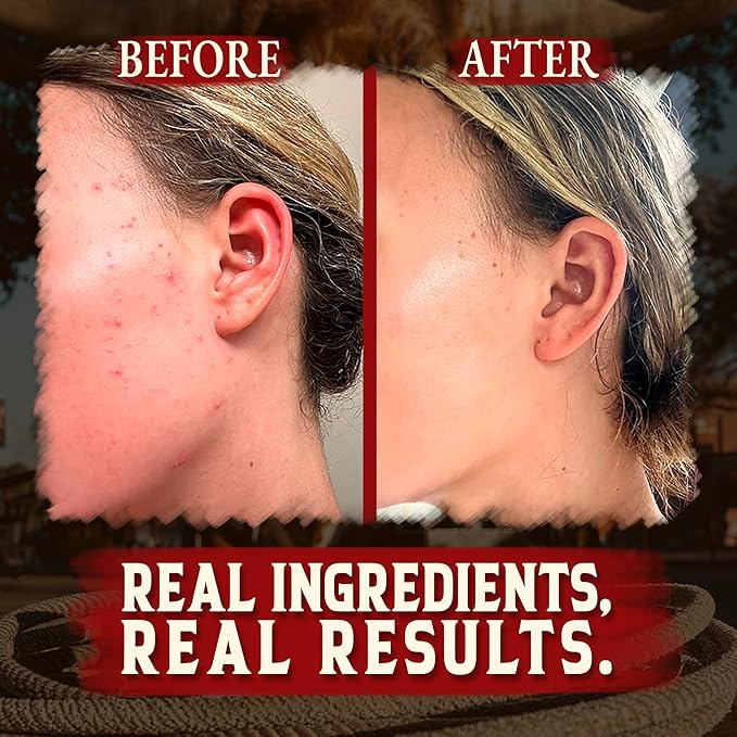 Organic Beef Tallow for Skin - 4 OZ (Vanilla) — Grass Fed Beef Tallow for face + Body — US-Made Whipped Tallow and Honey Balm Moisturizer for Dry and Sensitive Skin, Eczema, Rosacea (No Additives)