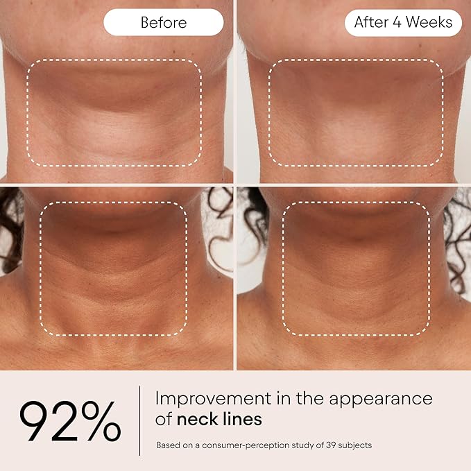 ALPYN Super Sculpt Serum, Face & Neck with Tri-Peptide Firming Complex, 1.7 oz