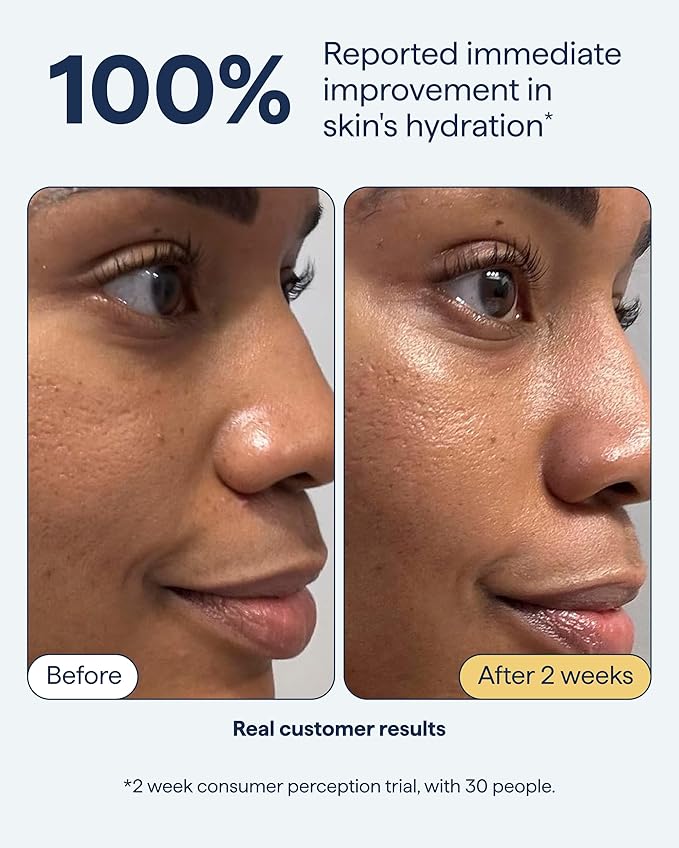 Remedy for Rich Moisture - Barrier Repairing Rich Cream Moisturizer for Normal to Dry Skin - Quadruple Ceramide Complex, Peptides, Squalane, Glycerin- By Dermatologist Dr. Shah, 1.7 fl. oz