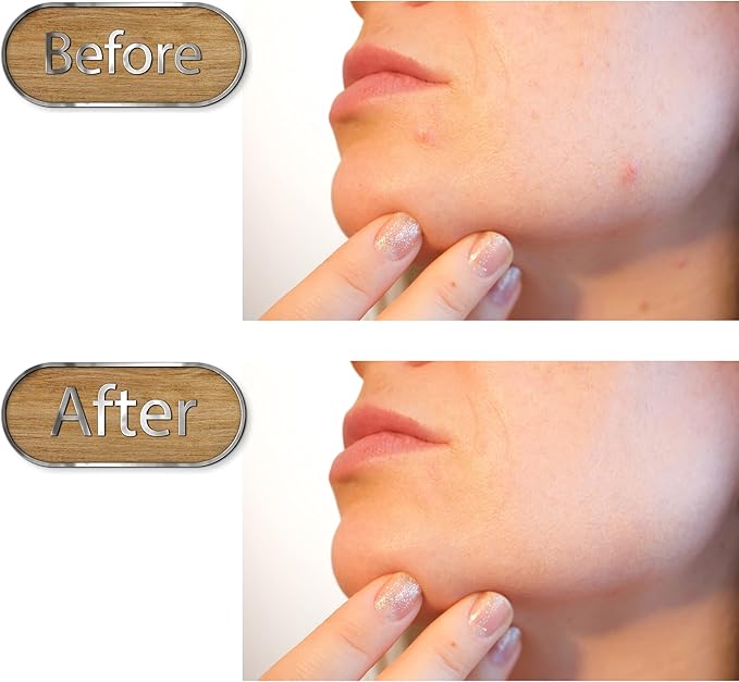 Pore Scraper, Stainless Steel Facial Cleaner Shovel, Double-Head Blackhead Remover Sticks, Face Skin Care Tool, Comedones Extractor Tools for Acne, Comedone, Blackhead, Whitehead, Pimple