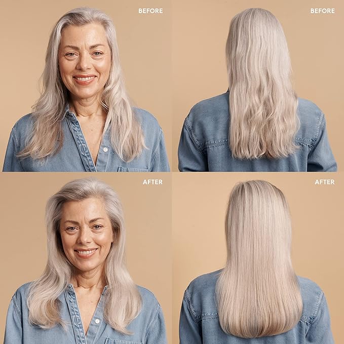 SEEN Conditioner Eco-Refill - Scented- Non-Comedogenic & Hair Conditioner- Dermatologist-Developed -Safe for Sensitive & Acne Prone Skin