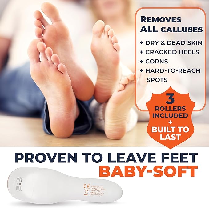Own Harmony Electric Callus Remover with Vacuum - Foot Care for Women - Professional Pedicure Tools for Powerful Pedi Care Vac - 3 Rollers Electric Feet File CR2100 - Best for Hard Dry, Cracked Heels