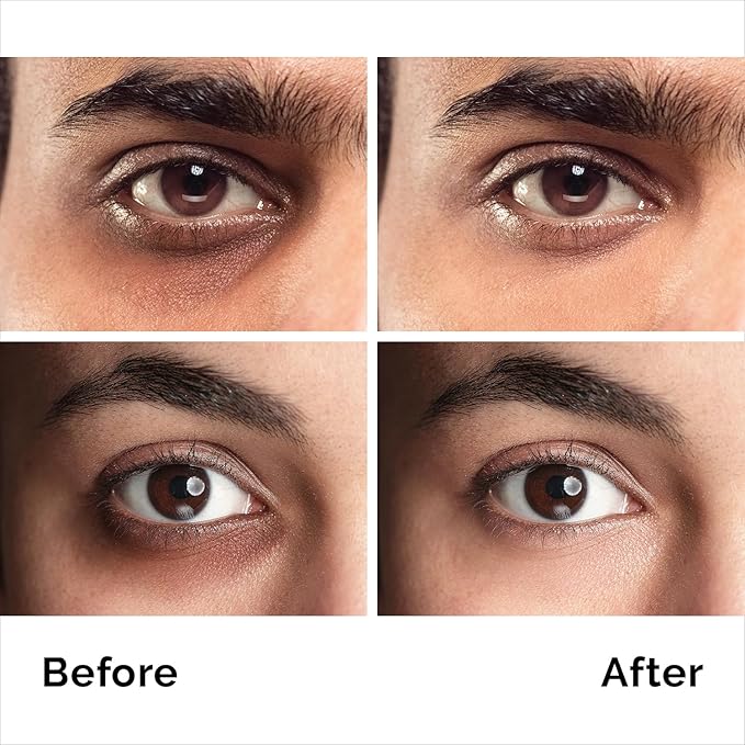 Caffeine Eye Cream For Anti Aging, Dark Circles, Bags, Puffiness. Great Under Eye Skin + Face Tightening, Eye Lift Treatment For Men & Women 1.7oz