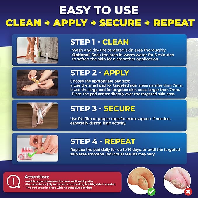 Corn Remover Pads for Feet Toes: 2 Boxes of 30 Pack Salicylic Acid Extra Strength Treatment - Fast Effective Medicated Bandages for Kids Adults Seniors Teens Runners Workers Men Women 60 Blue