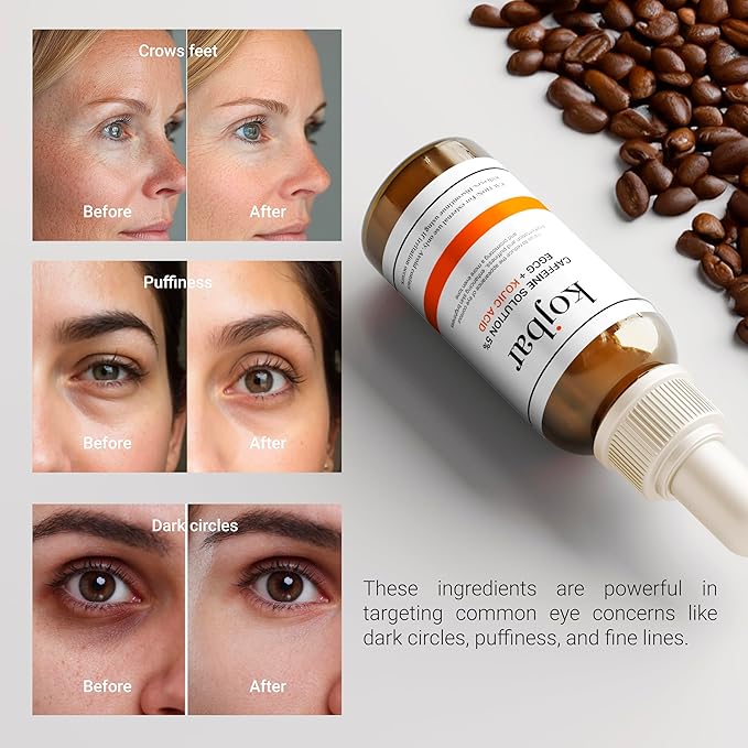 Caffeine Solution 5% + EGCG & Kojic Acid Eye Serum – Energizing Eye Treatment for Puffiness & Dark Circles, 1.01 fl oz