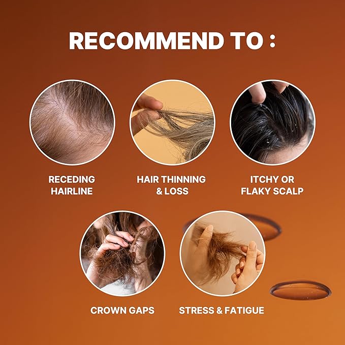 Scalp Intensive Shampoo with Biotin | Korean Shampoo for Hair Loss, Hair Regrowth, Thinning Hair, Volume Boost & Damage Repair (13.52 fl oz)