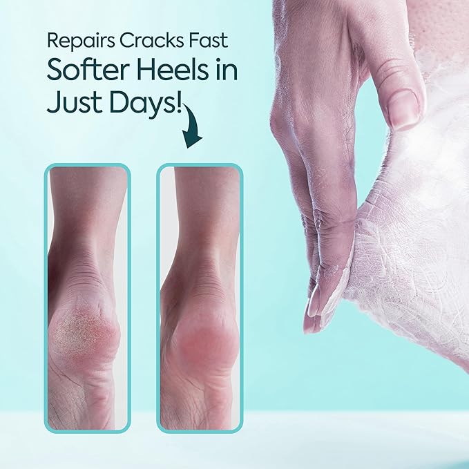 Foot Moisturizing Cream – Hydrating Heel & Foot Cream with Vitamin E and Avocado Oil – Softens Dry, Rough Skin – Nourishing Daily Foot Care, 100 ml