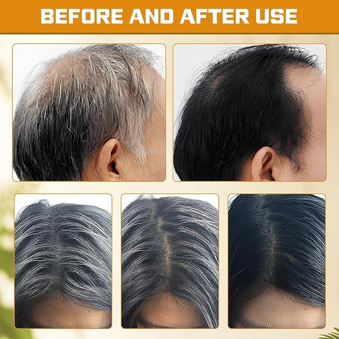 2PCS Gray Hair Reverse Shampoo Bar,Black Soap for Gray Hair,Black Soap for Women and Men