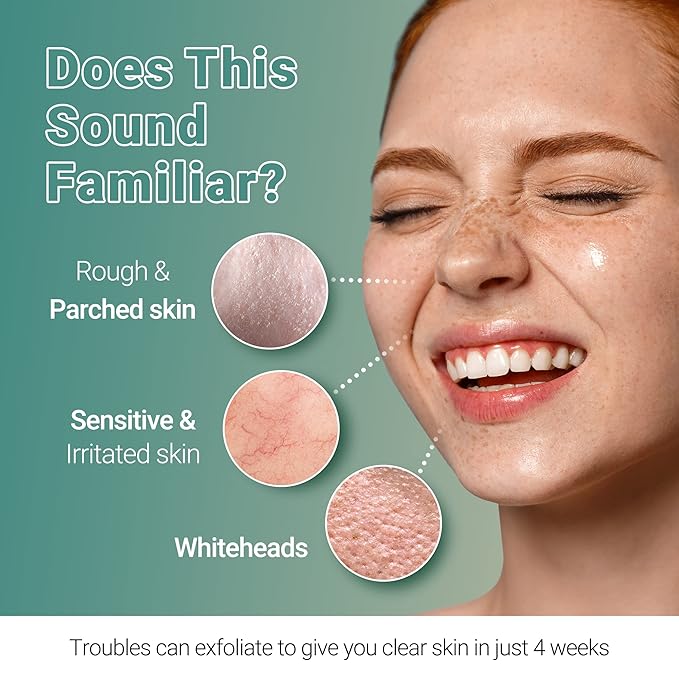 Troubless Clear Whitehead Remover Peel Off 5pcs. | Hydrating Beauty Sheets Day and Night Moisturizer for Face | White and Blackhead Remover Korean Skin Care Peel Off