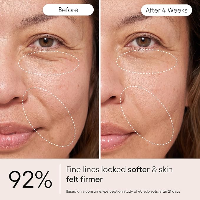 Alpyn Super Peptide & Ghostberry Moisturizer for Eczema, Barrier & Wrinkle Repair | Calm & Soothe Against Redness & Irritation (0.5 Oz)