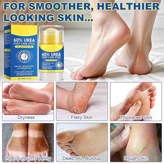60% Urea Cream Stick with 2% Salicylic Acid, Maximum Strength Urea Foot Cream Moisturizer, for Dry Cracked Heels, Knees, Elbows, Hands, Hydrates Dry Skin & Gently Exfoliates Dead Skin (2PCS)
